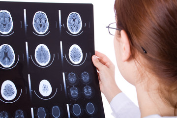 Female doctor examining a brain cat scan.