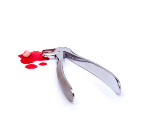 photo of tools in dental surgery