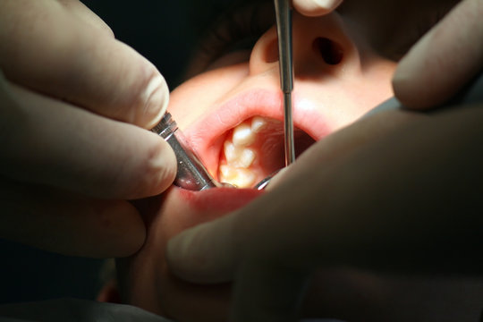beim Zahnarzt