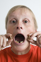 Portrait einer Frau mit Zahnausfall hochformat