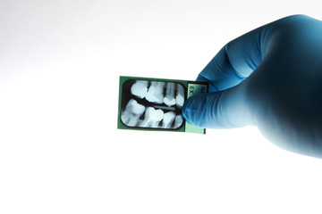 Dentist looking at xray of patients teeth