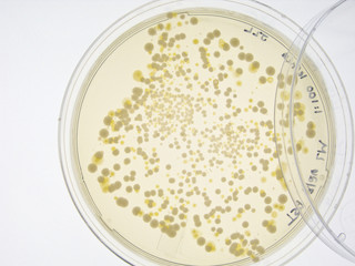 Bacterial colonies on agar plate