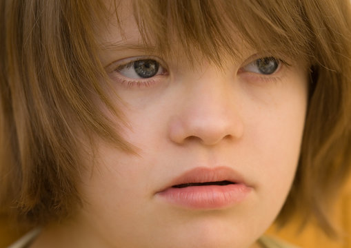 visage d'une enfant trisomique