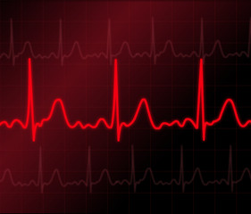 Illustration of electrical activity of the human heart