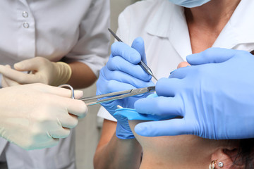 close up with hands in blue gloves and dental tools