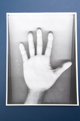Black and white Photocopy of hand
