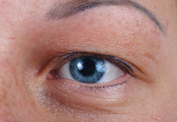 blue eye