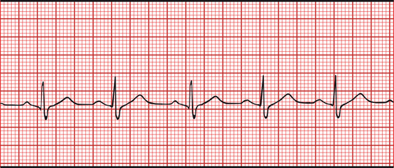 Normal electronic cardiogram vector illustration