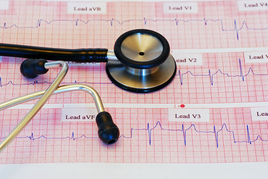 Stethoscope on an ECG - Powered by Adobe
