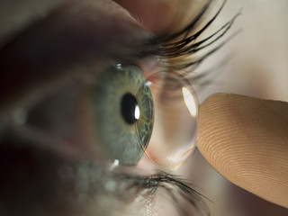 kontaktlinse ins auge2