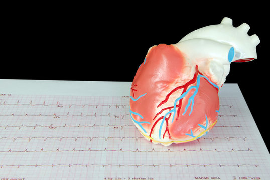 Heart on an Ecg