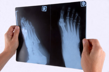 Cliché du pied