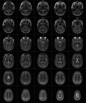 IRM du cerveau - S&eacute;rie 2