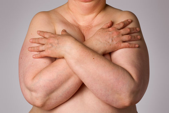Overweight woman covering breasts
