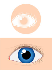 Eye pictogram