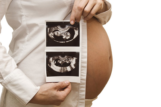 Embarazada mostrando ecografia