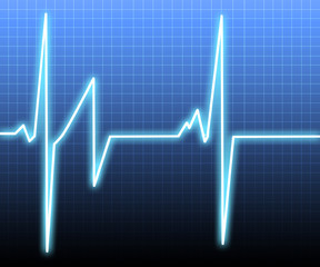 Heart beat on an ecg