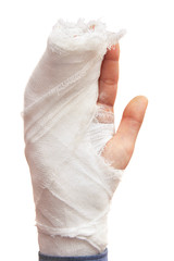 Broken hand isolated on white.