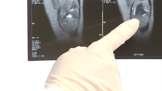 Comparison between two x-rays in hospital