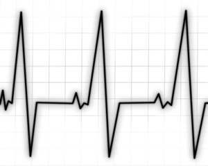 Heart monitor
