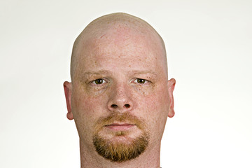 Bald Man © Mat Hayward