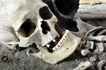 skull
