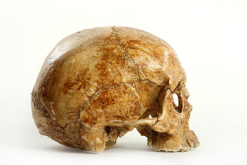 Skull