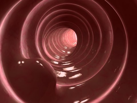 darmpolyp - nahaufnahme