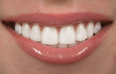 Fototapeta premium Teeth