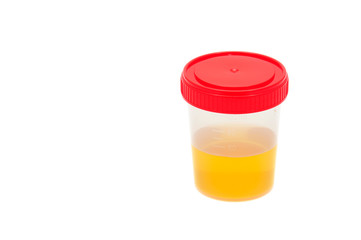 Urine