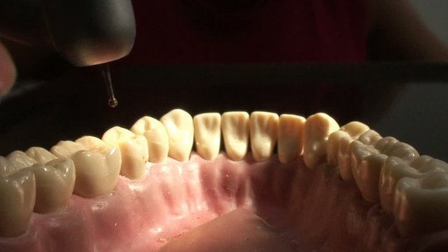 Soins dentaires (avec son).