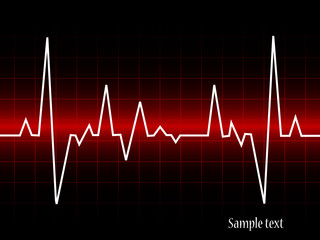 electrocardiogram- vector illustration