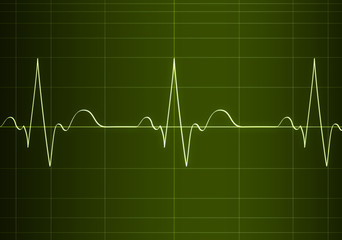 Cardiogram