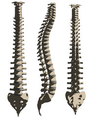 wirbelsäule - verschiedene ansichten