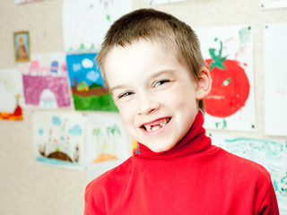 Boy shows missing teeth
