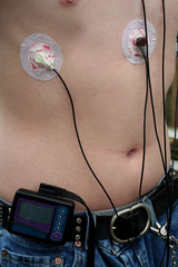 Portable Heart Monitor on Teen