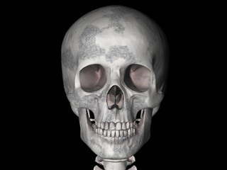 skull