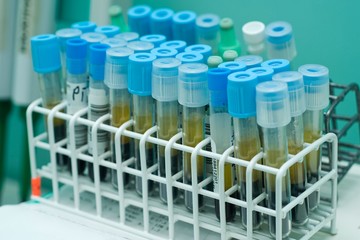 close up of test tubes in white rack