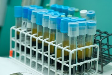close up of test tubes with blue cups