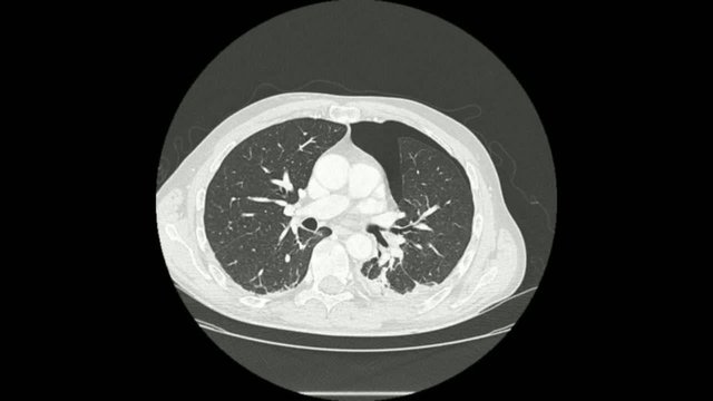 Radiology - thoracic ct scan