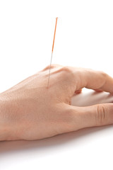Acupunctured hand (vertical)