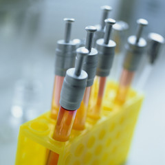 Ampullen Labor Chemie Arzt