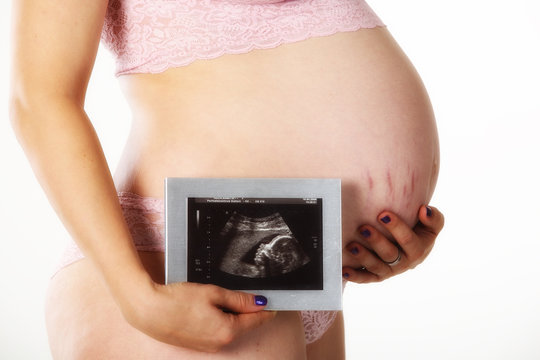 Babybauch und Ultraschallbild