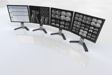 Medical computer monitor