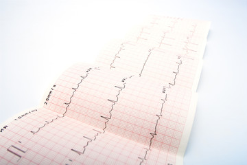 Electrocardiogram, waveform from EKG test