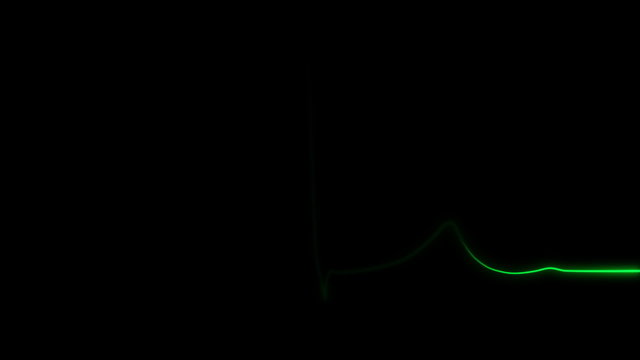 Electrocardiogram displaying heartbeat or pulse
