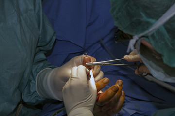 microchirurgia ricostruttiva