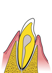 dente - odontoiatria -  sezione