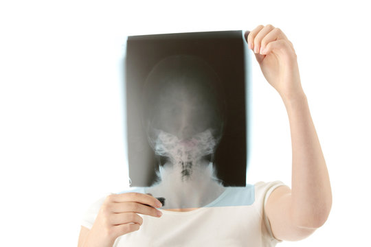 X-ray photo scan