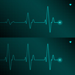 ECG tracing. Vector illustration.